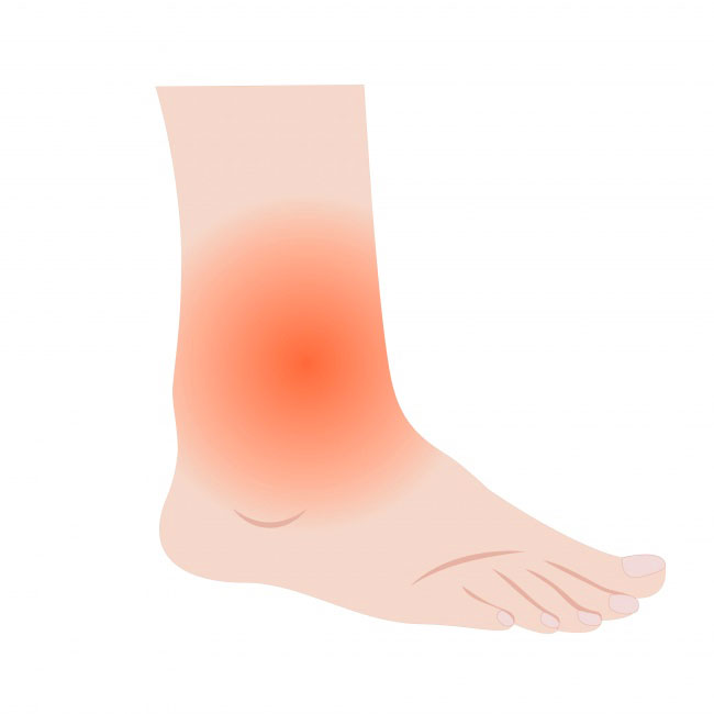 Ankle, Hands, and Feet Becomes Swollen - Bestoknow